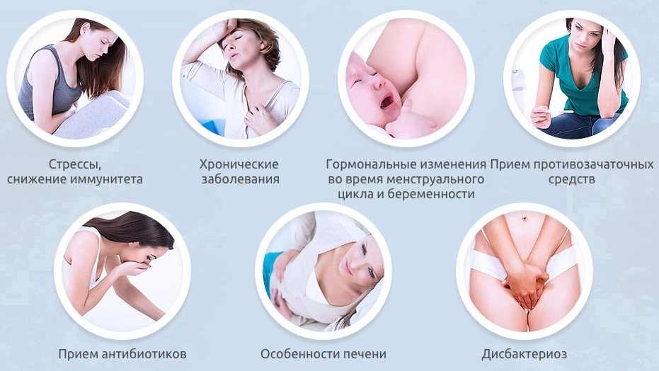Что делать, если молочница повторяется