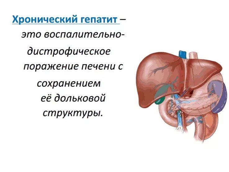 Хронический гепатит