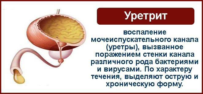 Инфекция уретры