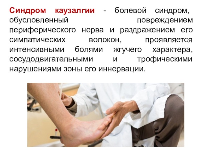 Каузалгия