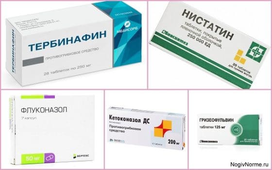 Кетоконазол
