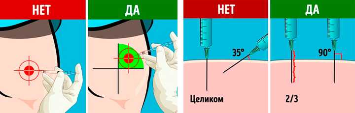 Ощущение жжения после инъекции в вену