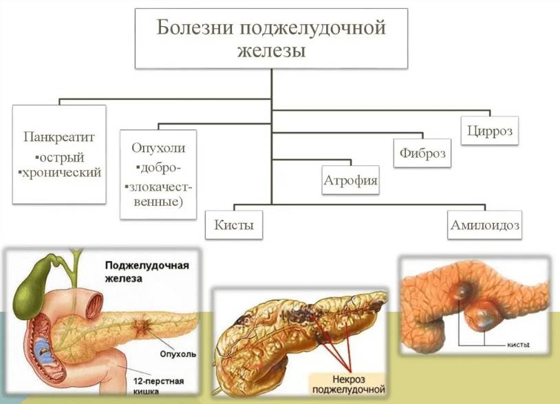 Поджелудочная железа