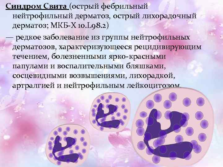 Синдром Свита