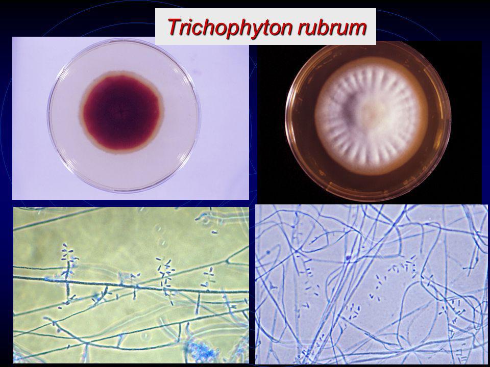 Trichophyton rubrum 