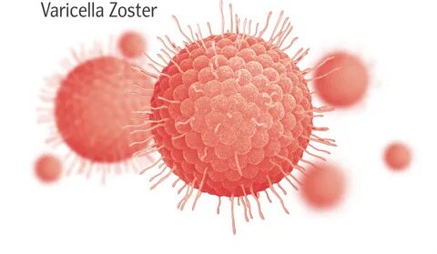 Varicella zoster