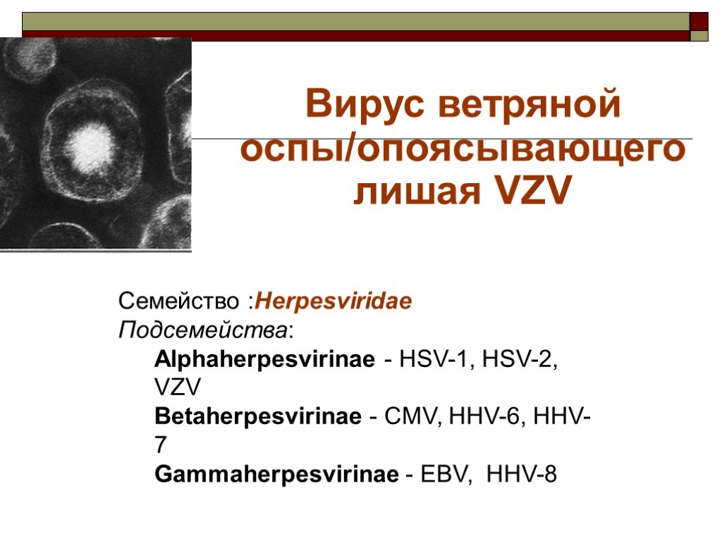 Ветряная оспа и опоясывающий лишай