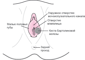 Виды вагинальных кист