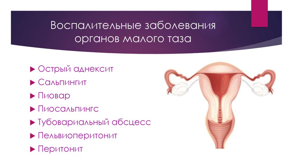 Воспалительные заболевания органов малого таза