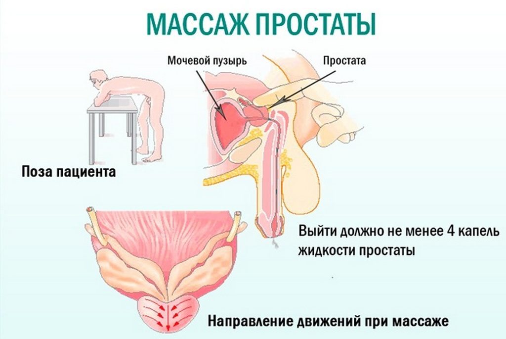 Жжение после массажа простаты