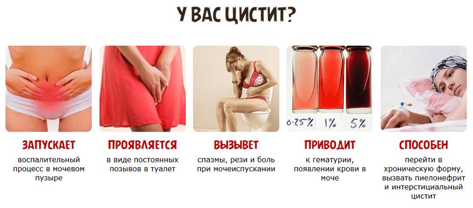 Жжение при цистите у женщин