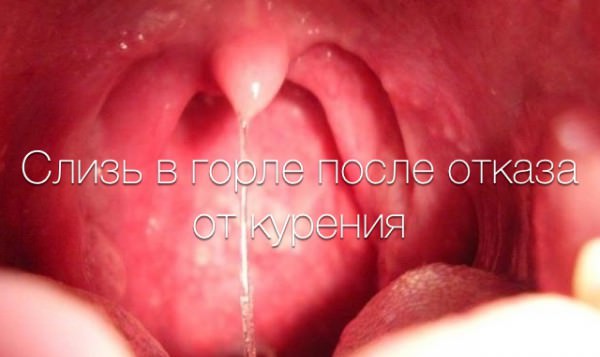 Жжение в горле после курения и изменения голоса