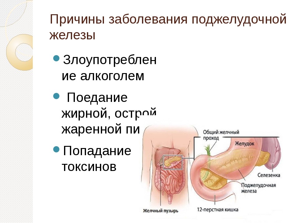 Жжение в желудке поджелудочной железе 