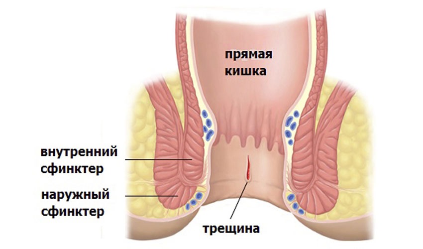 анальных сфинктеров