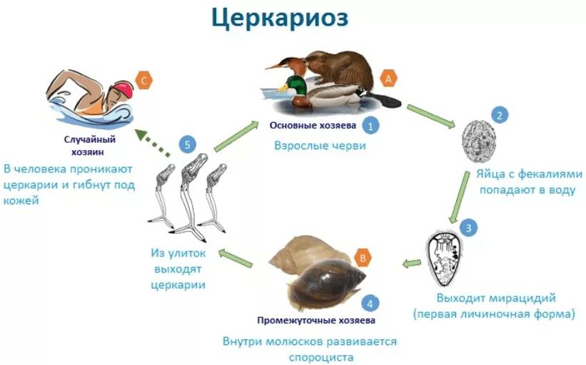 церкариоз