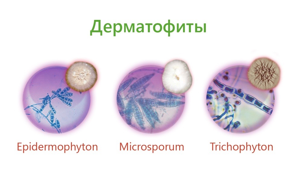 Дерматофиты