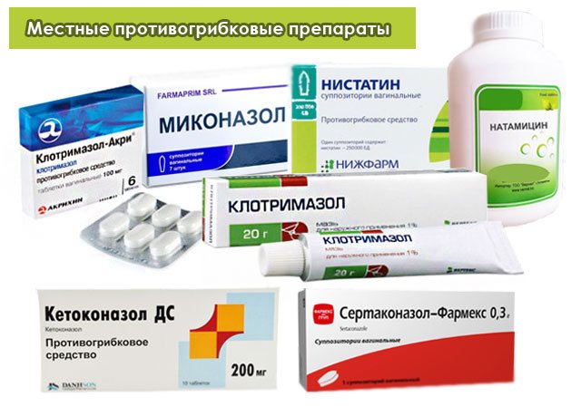 местными противогрибковыми препаратами