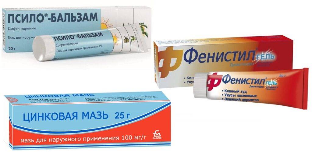 е мази от зуда кожи