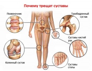 причины болей в суставах