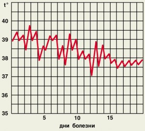 Температурная кривая при неправильной лихорадке