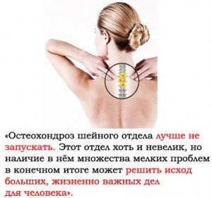 остеохондроз шейного отдела
