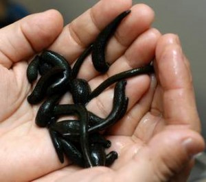 пиявки при лечении коленного сустава