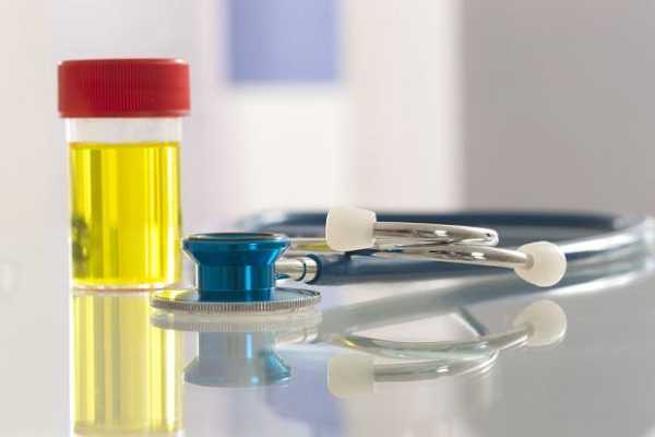 trimetilaminuriya-prichiny-i-lechenie