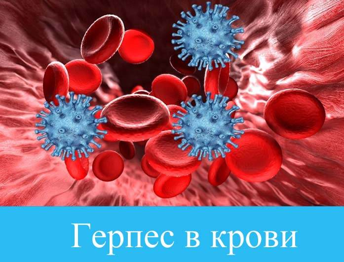 Герпес в крови