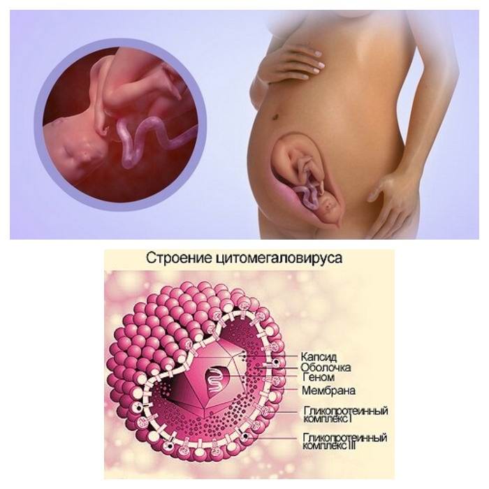 Что такое цитомегаловирус igg при беременности