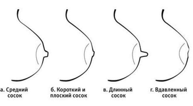 Виды сосков
