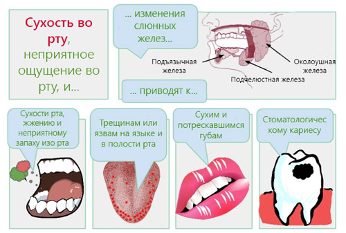 Почему сохнет во рту днем или ночью