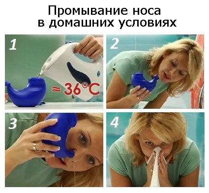 Что нужно для самостоятельного промывания носа в домашних условиях 