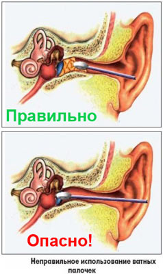 на фото показано, как нельзя чистить серу в ушах 
