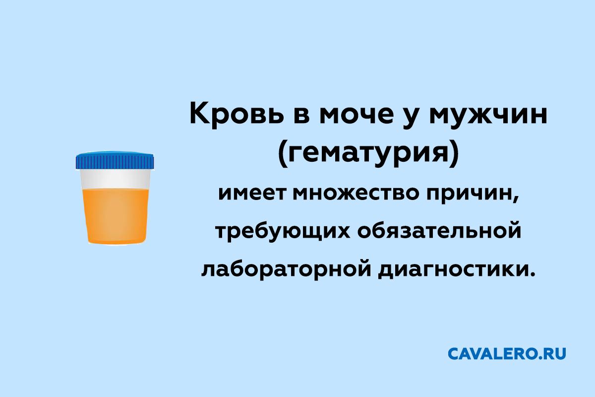 Гематурия у мужчин (кровь в моче)