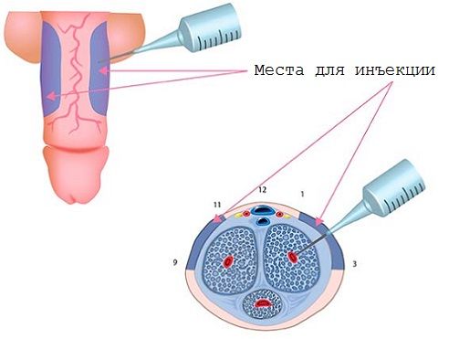 Вазоактивный тест на потенцию