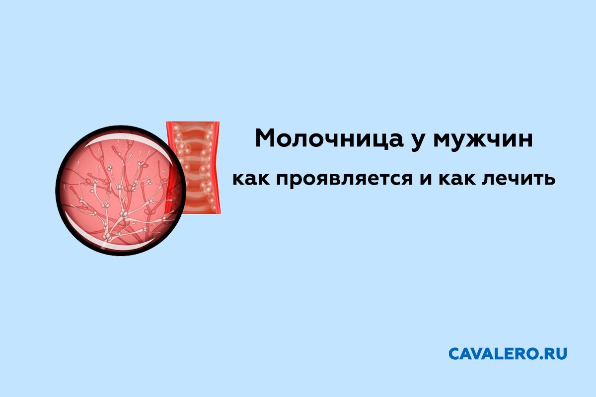 Как проявляется и как лечить молочницу у мужчин