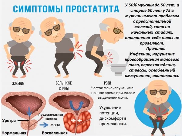 Влияет ли уреаплазма на потенцию?