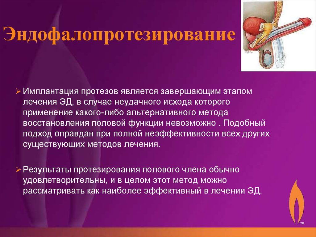 Эндофаллопротезирование