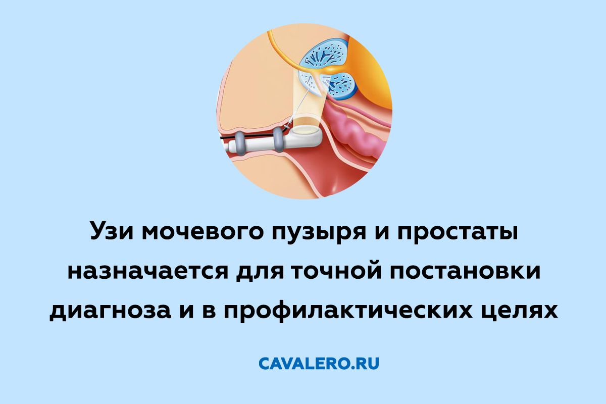 УЗИ простаты и мочевого пузыря у мужчин