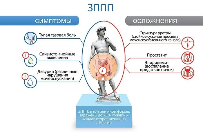 Боль при эрекции и ее основные причины фото
